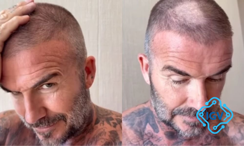 Imagem de capa para David Beckham tenta cortar o cabelo sozinho e resultado virou meme na internet