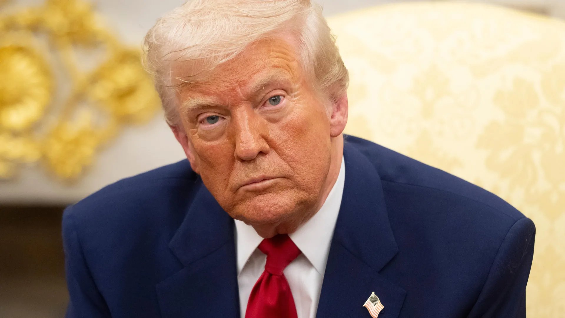 Imagem de capa para Presidente Trump diagnosticado com Insuficiência Venosa Crônica: Conheça os riscos e tratamentos